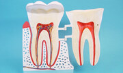 Human Tooth 8:1